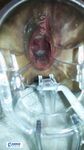 高顏值氣質御姐KTV消遣被暗中下料 帶到賓館扒光各種玩弄調教啪啪無套內射內窺鏡看子宮沖洗陰道2